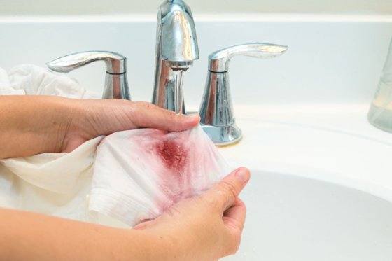 Как отмыть пятна крови с ткани без химчистки?